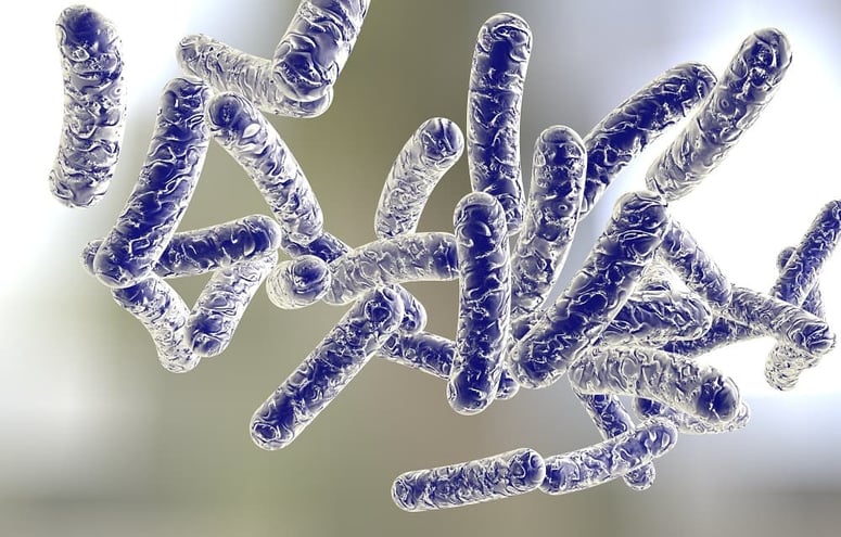 Legionella